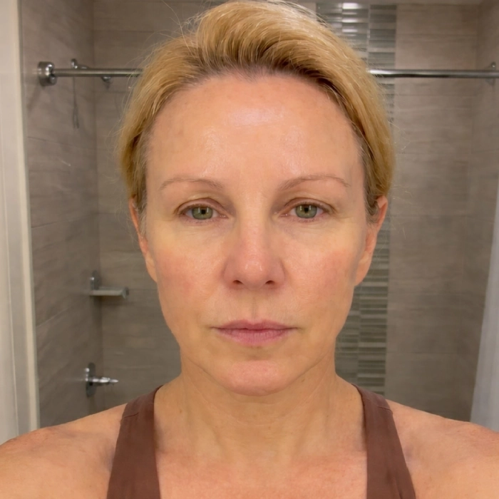 After - Cristina, 39 · 8 weeks of use