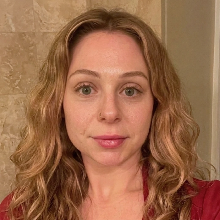 Before - Sara, 32 · 4 weeks of use
